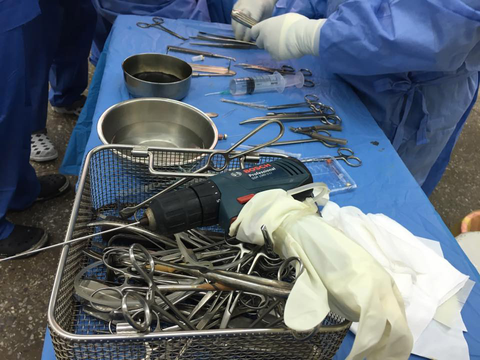 現地の病院には骨折の手術に必要な器材、プレート、スクリューなどが不足しているため、あるもので何とかするしかない（写真提供：ウィズアウトボーダー）