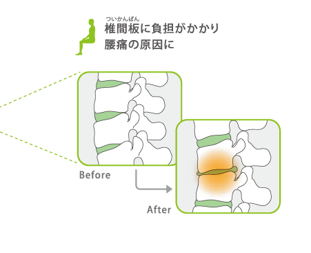 椎間板に負担がかかり腰痛の原因に